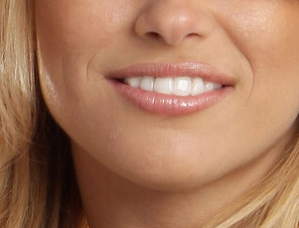 sorriso di donna per pagina estetica dentale