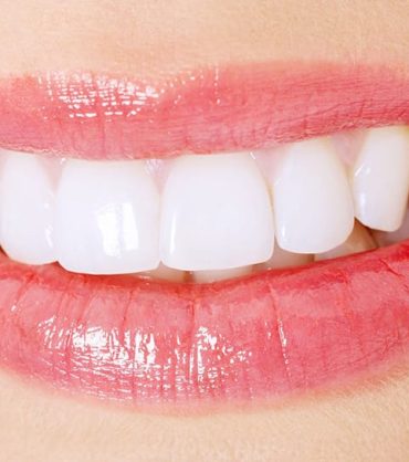 bel sorriso di estetica dentale