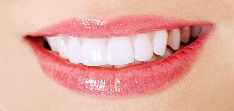 bel sorriso di estetica dentale