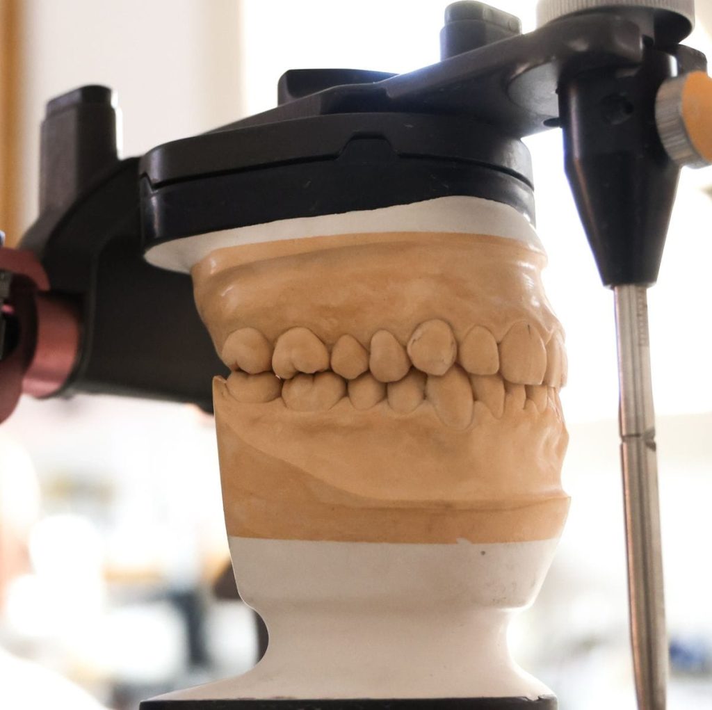 lavori odontotecnici: occlusione