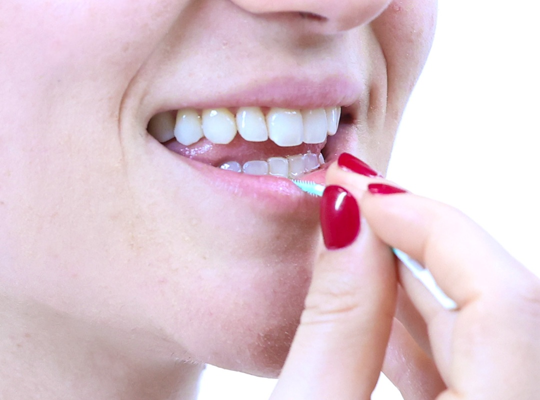 Lavare i denti con spazzolino interdentale